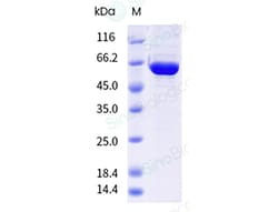 Sino Biological&nbsp;Influenza A H1N1 (A/Wisconsin/67/2022) Nucleoprotein/NP Protein (His & AVI Tag), Biotinylated
