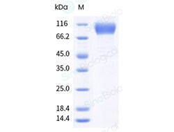 Sino Biological&nbsp;Recombinant Mouse IL-31RA Protein (His Tag)