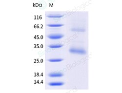 Sino Biological&nbsp;Recombinant Mouse GPRC5D Protein (Nanodisc, His Tag)