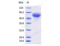 Sino Biological&nbsp;HSV 2 (strain 333) gE/glycoprotein E Protein (His Tag)(MALS-verified)