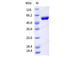 Sino Biological&nbsp;Influenza A H3N2 (A/Croatia/10136RV/2023; A/District of Columbia/27/2023) Nucleoprotein / NP Protein (His Tag)(HPLC-verified)