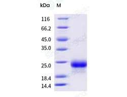 Sino Biological&nbsp;Recombinant Cynomolgus, Rhesus IL-17F Protein (His Tag)