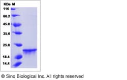 Sino Biological&nbsp;Recombinant Human FGF-8 Protein