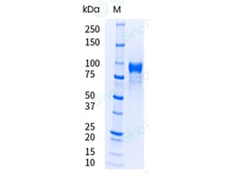 Sino Biological&nbsp;Recombinant Human HER3/ERBB3 Protein (ECD, His Tag), HPLC-verified, Endotoxin-Free
