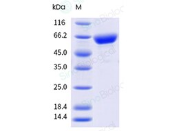 Sino Biological&nbsp;Human respiratory syncytial virus (RSVB) Prefusion glycoprotein F/ RSV-preF trimer Protein (His & AVI Tag), Biotinylated (MALS-verified)