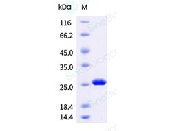 Sino Biological&nbsp;HIV-1 p24 Protein (strain CRF 01_AE) (His Tag)