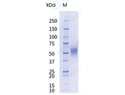 Sino Biological&nbsp;Recombinant Mouse uPAR/PLAUR Protein (His Tag), HPLC-verified, Endotoxin-Free