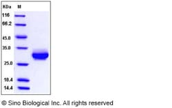 Sino Biological&nbsp;Recombinant Rat C-Reactive Protein Protein (His Tag)