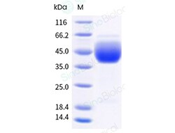 Sino Biological&nbsp;Recombinant Cynomolgus IL-22BP Protein (His Tag), HPLC-verified