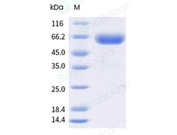 Sino Biological Recombinant Cynomolgus GLP2R Protein (ECD, hFc Tag), HPLC-verified,