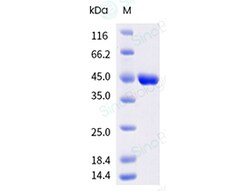 Human respiratory syncytial virus (RSV) Nucleoprotein Protein (AVI & His Tag), Biotinylated 20µg