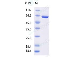 Influenza A H1N1 (A/Victoria/4897/2022) Nucleoprotein / NP Protein (His & AVI Tag), Biotinylated