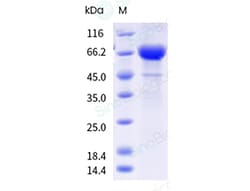 Sino Biological&nbsp;Influenza A H3N2 (A/Thailand/8/2022) Neuraminidase/NA Protein (ECD, His & AVI Tag), Biotinylated