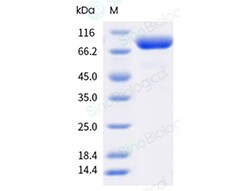 Sino Biological&nbsp;HSV 2 (strain 333) Glycoprotein B Protein (His Tag) (MALS-verified)