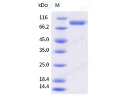 Sino Biological&nbsp;Influenza A H1N1 (A/Wisconsin/67/2022) Hemagglutinin / HA trimer Protein (His & AVI Tag), Biotinylated (MALS-verified)