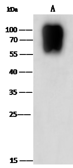 Sino Biological Varicella-zoster virus (VZV) / HHV-3 gE / glycoprotein