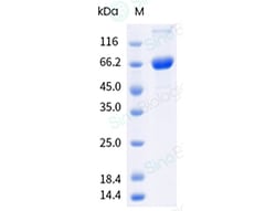 Sino Biological&nbsp;Influenza A H1N1 (A/Victoria/4897/2022) Neuraminidase / NA Protein (ECD, His & AVI Tag), Biotinylated