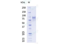 Sino Biological Recombinant Cynomolgus SLC39A6/LIV-1 Protein (hFc Tag),