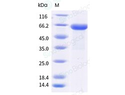 Sino Biological&nbsp;Recombinant Human DcR3/TNFRSF6B Protein (hFc Tag), Biotinylated