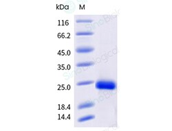 Sino Biological&nbsp;Recombinant Human DcR3/TNFRSF6B Protein (His Tag), Biotinylated