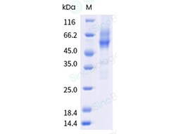 Sino Biological&nbsp;Recombinant Human CNR1 Protein (Nanodisc, Flag-His Tag)
