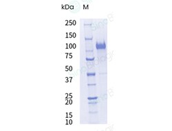 Sino Biological&nbsp;Recombinant Cynomolgus Cadherin-17 Protein (His Tag), HPLC-verified, Endotoxin-Free