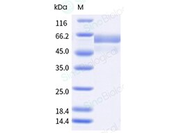 Sino Biological Human respiratory syncytial virus RSV (A2) Prefusion glycoprotein