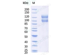 Sino Biological&nbsp;Recombinant Cynomolgus H Cadherin Protein (His & AVI Tag), Avi-tag Biotinylated