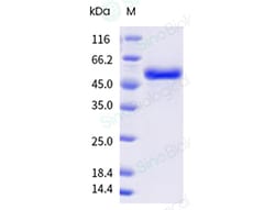 Sino Biological&nbsp;Recombinant Canine DLL3 Protein (His Tag), HPLC-verified