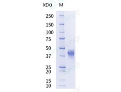 Sino Biological&nbsp;Recombinant Cynomolgus Nectin-4 Protein (ECD, His Tag), HPLC-verified, Endotoxin-Free