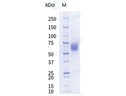 Sino Biological&nbsp;Recombinant Human FGFR3 Protein (ECD, His Tag), HPLC-verified, Endotoxin-Free