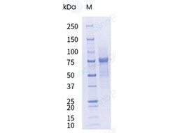 Sino Biological&nbsp;Recombinant Human LRRC15 Protein (ECD, His Tag), HPLC-verified, Endotoxin-Free