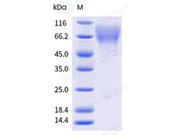 Human RSV (B1) glycoprotein G / RSV-G Protein (His & AVI Tag), Biotinylated 20µg