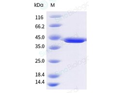Sino Biological&nbsp;Recombinant P. falciparum Aldolase Protein