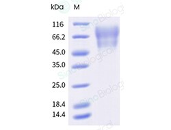 Human respiratory syncytial virus (RSV) (A, rsb1734) glycoprotein G / RSV-G Protein (95% Homology) (His & AVI Tag), Biotinylated 20µg