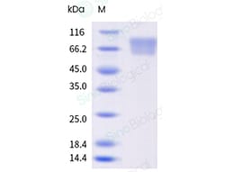 Varicella-zoster virus (VZV) (strain Oka vaccine) gE / glycoprotein E Protein (His & AVI Tag), Biotinylated (MALS-verified)