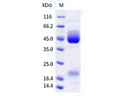 Sino Biological&nbsp;Human respiratory syncytial virus (RSVB) Post-fusion glycoprotein F/ RSV post-F Protein (His & AVI Tag), Biotinylated (MALS-verified)