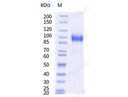 Sino Biological Rat Her2/ERBB2 Protein 50µg, Quantity: Each of 1