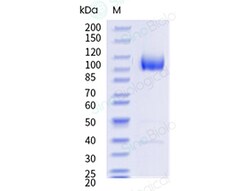 Sino Biological Recombinant Rhesus RP105/CD180 Protein (His & AVI Tag), Avi-tag Biotinylated, HPLC-verified