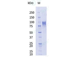 Sino Biological&nbsp;Recombinant Rat SLC39A6/LIV-1 Protein (hFc Tag), HPLC-verified, Endotoxin-Free