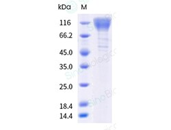 Sino Biological&nbsp;Recombinant Rat IL-31RA Protein (His Tag)