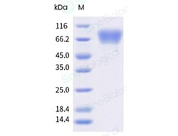 Varicella-zoster virus (VZV) / HHV-3 gE / glycoprotein E Protein (ECD, His Tag), Biotinylated