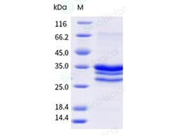 Sino Biological Recombinant Mugwort Allergen Art v 3.03 250µg, Quantity:
