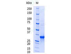 Sino Biological&nbsp;Recombinant Human KLK3/PSA Protein (His Tag), HPLC-verified, Endotoxin-Free
