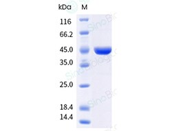 Human respiratory syncytial virus (RSV) (strain A2, strain Long) Nucleoprotein Protein (His & AVI Tag), Biotinylated 20µg