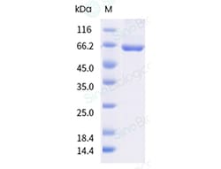 Sino Biological&nbsp;Influenza B (B/Austria/1359417/2021) Nucleoprotein / NP Protein (His & AVI Tag), Biotinylated