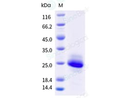 Sino Biological Recombinant Cynomolgus LYPD6B Protein (His & AVI Tag), Avi-tag Biotinylated, HPLC-verified