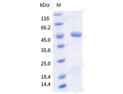 Sino Biological&nbsp;Human respiratory syncytial virus (RSVA) (A2) Postfusion glycoprotein F/ RSV-postF Protein (His & AVI Tag), Biotinylated(MALS-verified)