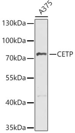 ABclonal Technology&nbsp;CETP Rabbit pAb