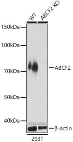 ABclonal Technology&nbsp;[KO Validated] ABCF2 Rabbit pAb